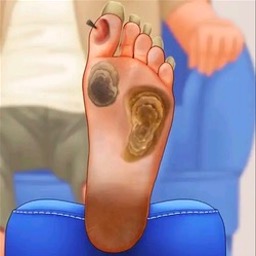 修脚足疔模拟器精简版