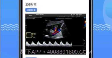 超声智库v1.2.31截图