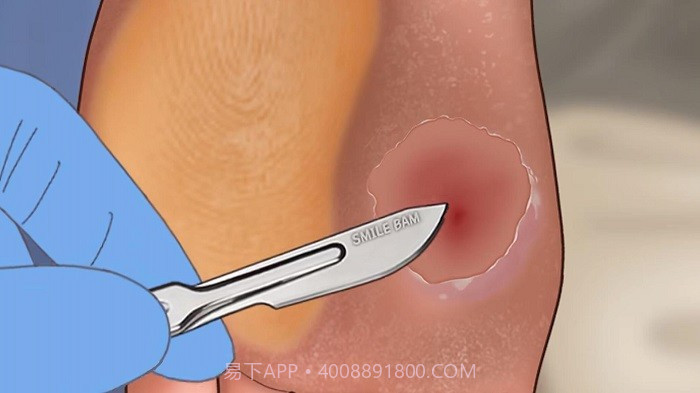 修脚足疔模拟器高画质版v1.0截图