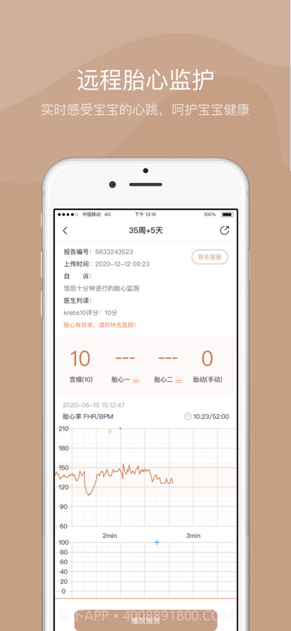 智胎心截图2 智胎心截图2