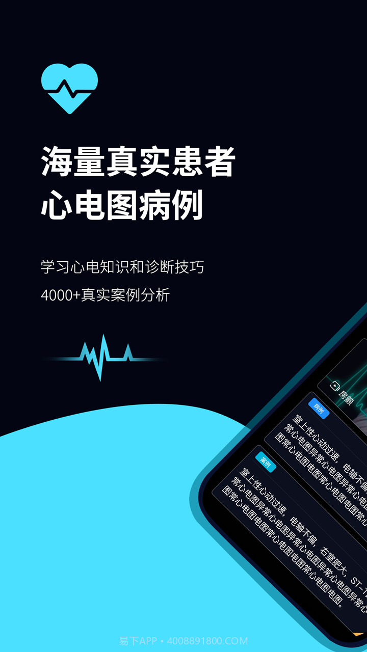 心电图ECG截图1 心电图ECG截图1