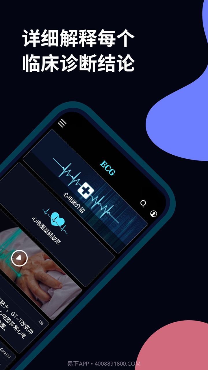 心电图ECG截图2 心电图ECG截图2