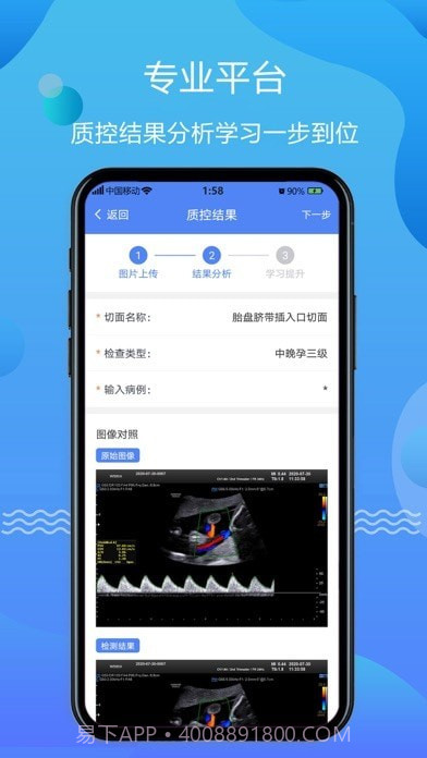 超声智库截图3