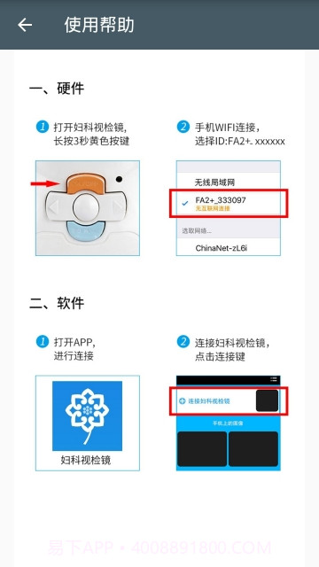 妇科视检镜截图2 妇科视检镜截图2