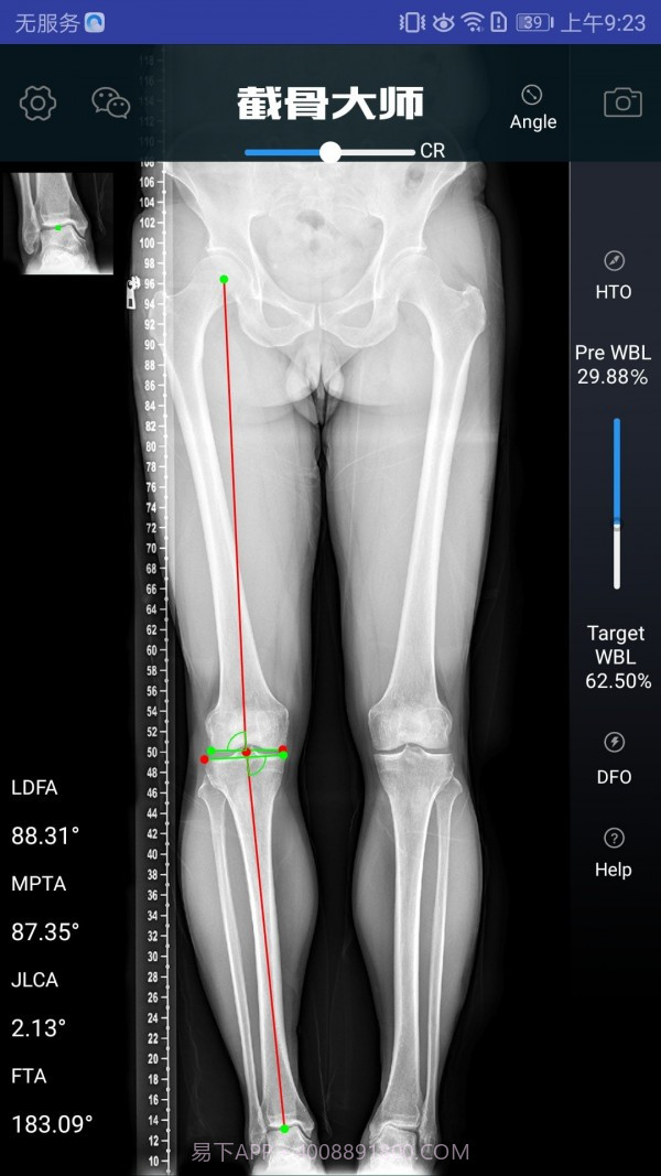 截骨大师截图3 截骨大师截图3