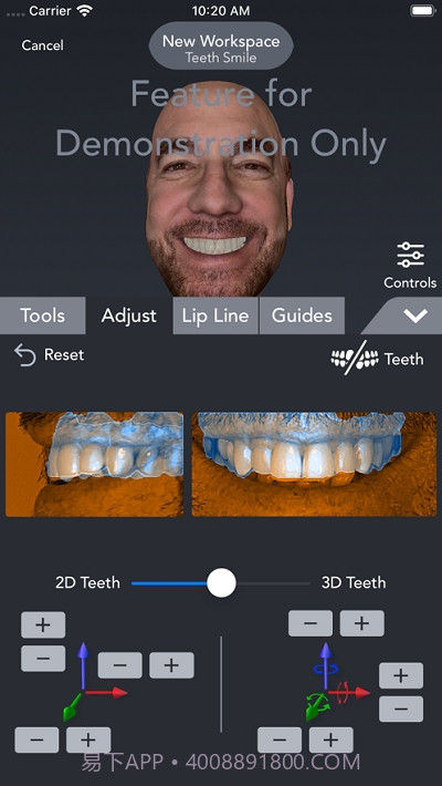 Bellus3D Dental Pro截图4 Bellus3D Dental Pro截图4