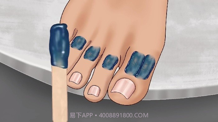 修脚足疔模拟器单机版截图2 修脚足疔模拟器单机版截图2